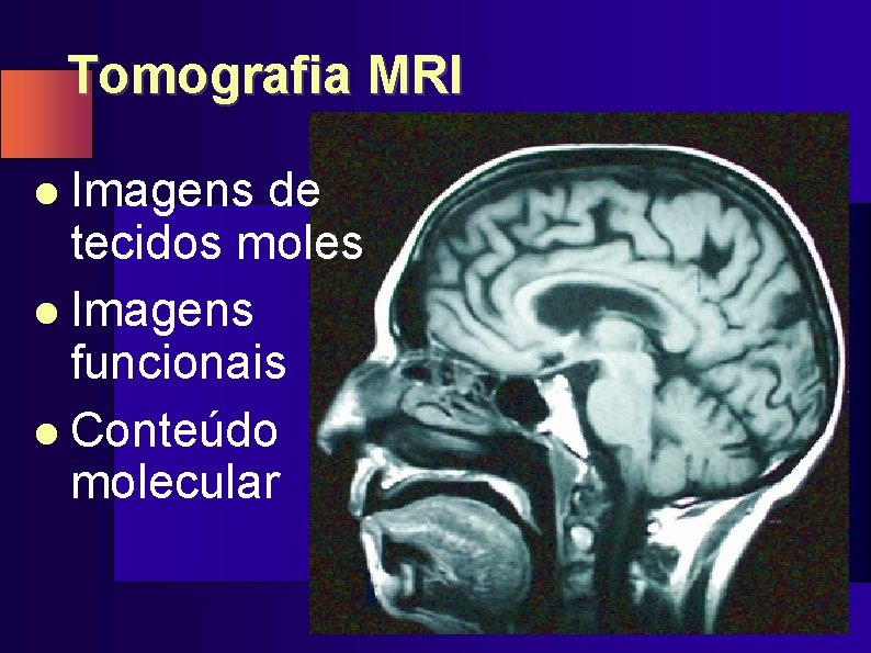 Tomografia MRI l Imagens de tecidos moles l Imagens funcionais l Conteúdo molecular 