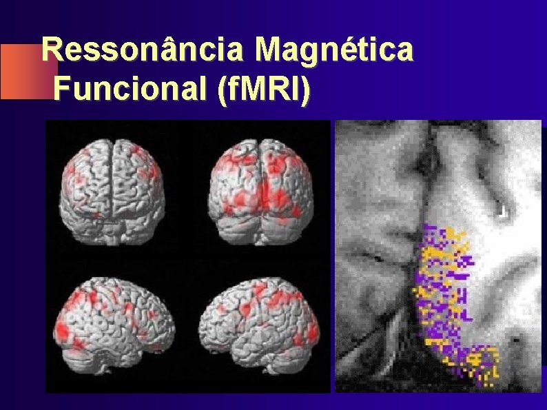 Ressonância Magnética Funcional (f. MRI) 