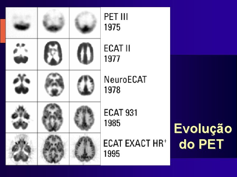 Evolução do PET 