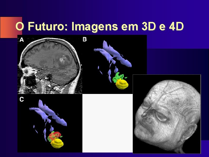 O Futuro: Imagens em 3 D e 4 D 