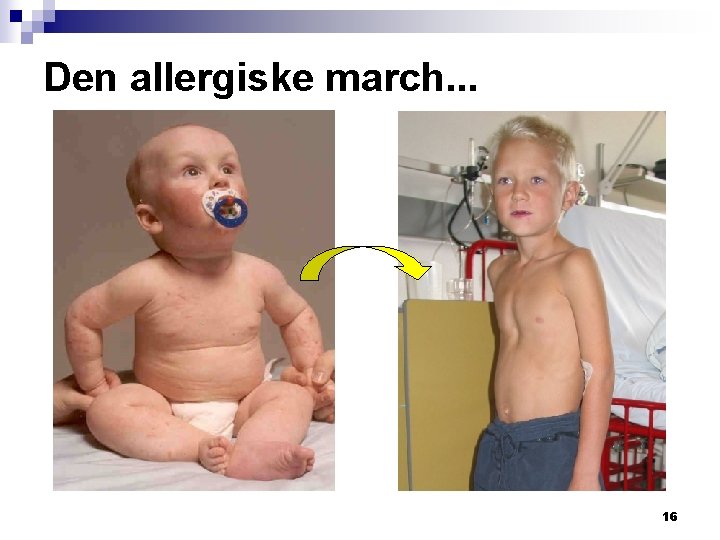 Den allergiske march. . . 16 