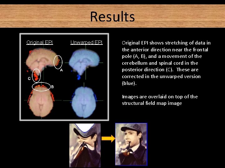 Results Original EPI Unwarped EPI Original EPI shows stretching of data in the anterior Results Original EPI Unwarped EPI Original EPI shows stretching of data in the anterior
