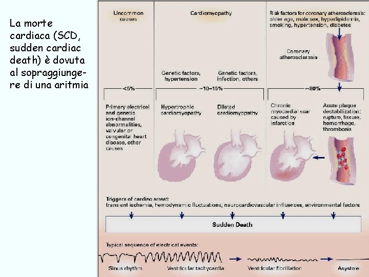 La morte cardiaca (SCD, sudden cardiac death) è dovuta al sopraggiungere di una aritmia