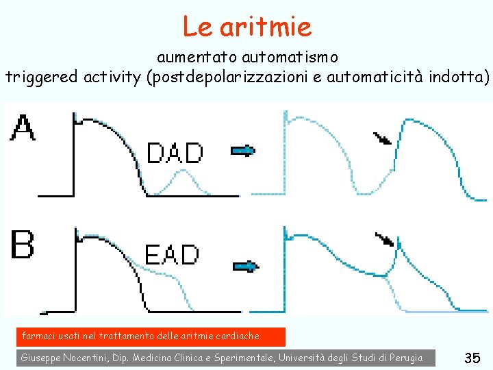 Le aritmie aumentato automatismo triggered activity (postdepolarizzazioni e automaticità indotta) farmaci usati nel trattamento