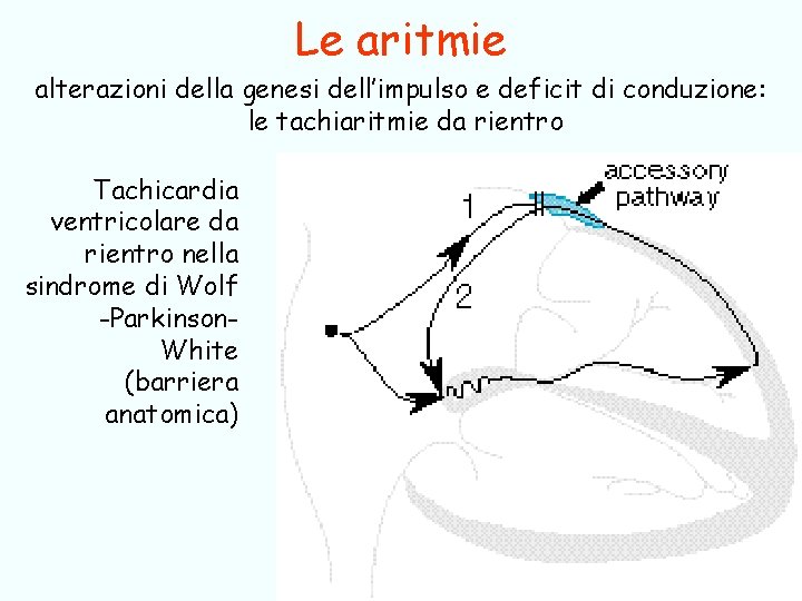 Le aritmie alterazioni della genesi dell’impulso e deficit di conduzione: le tachiaritmie da rientro