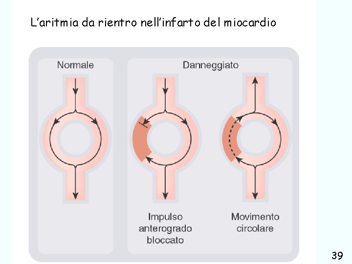 L’aritmia da rientro nell’infarto del miocardio farmaci usati nel trattamento delle aritmie cardiache Giuseppe