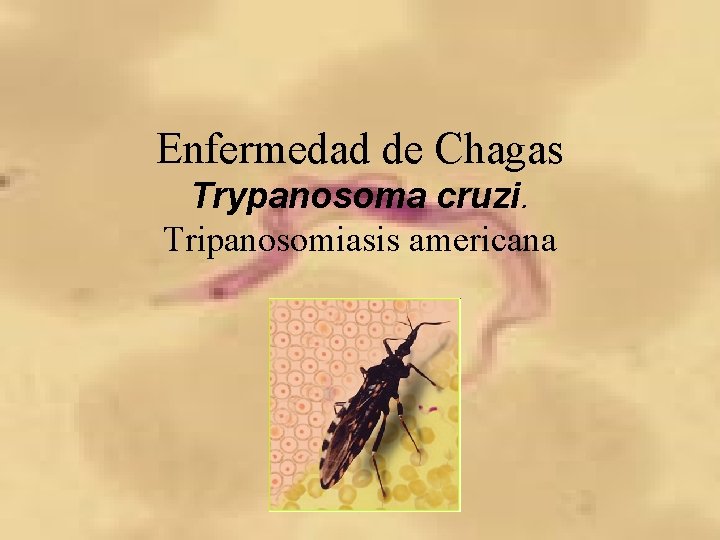 Enfermedad de Chagas Trypanosoma cruzi. Tripanosomiasis americana 