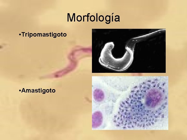 Morfología • Tripomastigoto • Amastigoto 