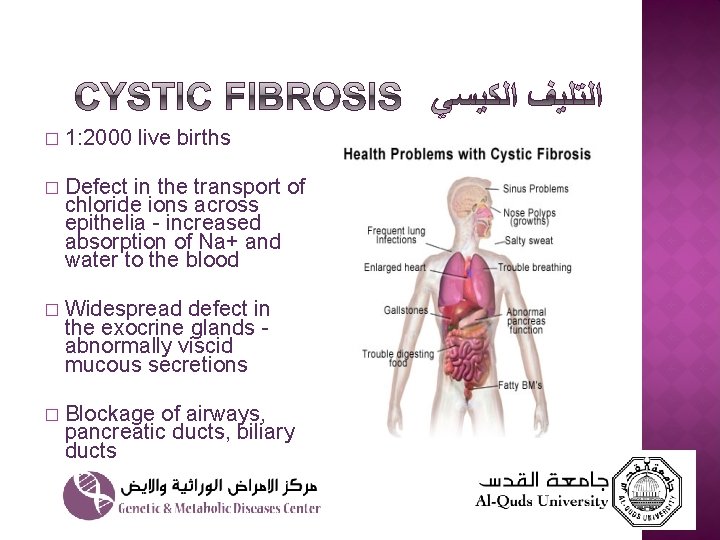 � 1: 2000 live births � Defect in the transport of chloride ions across