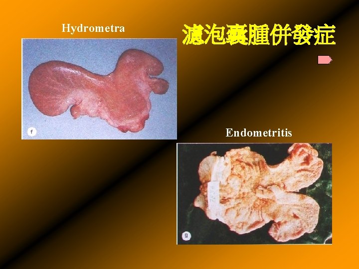 Hydrometra 濾泡囊腫併發症 Endometritis 