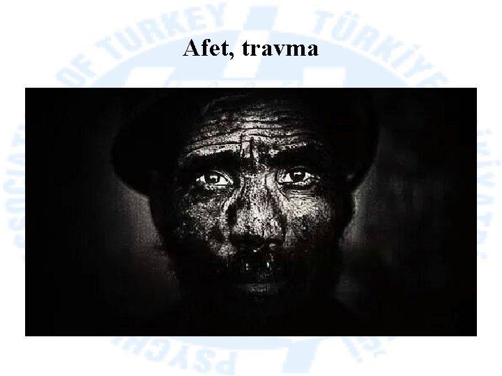 Afet, travma 