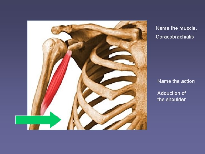 Name the muscle. Coracobrachialis Name the action Adduction of the shoulder 