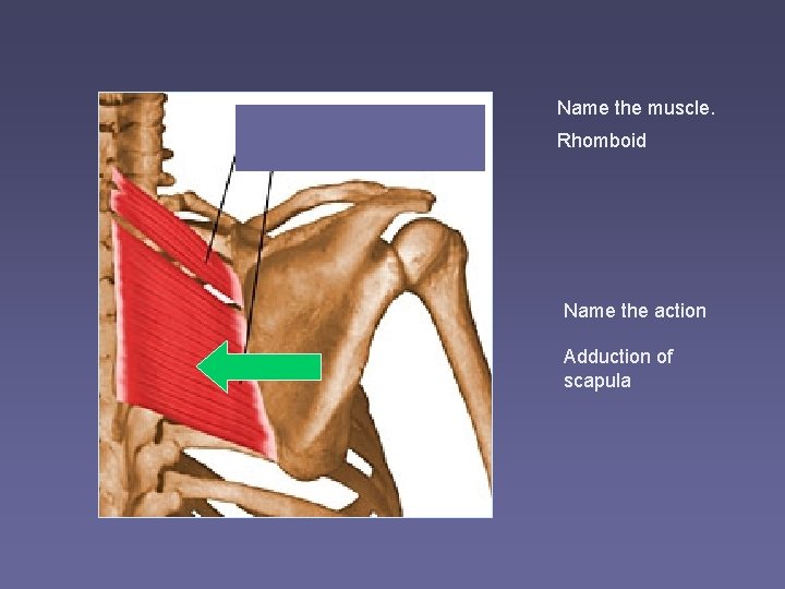 Name the muscle. Rhomboid Name the action Adduction of scapula 