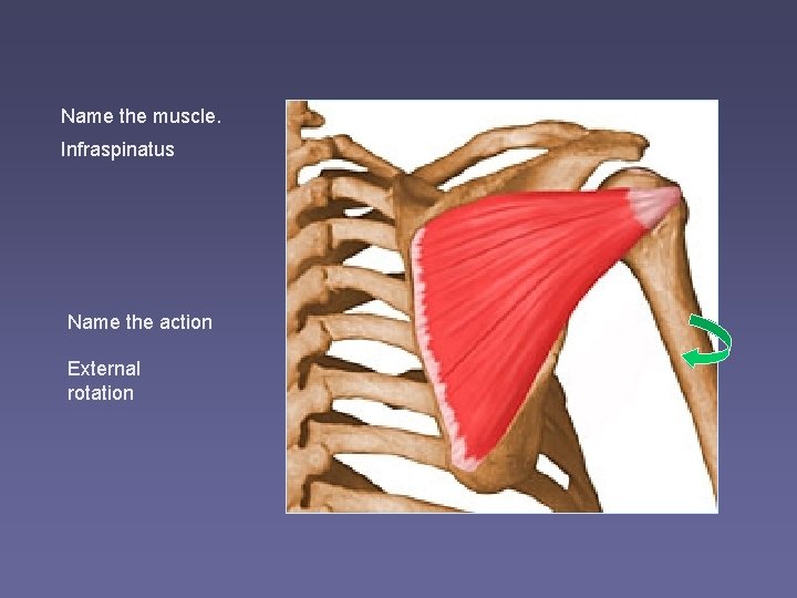 Name the muscle. Infraspinatus Name the action External rotation 