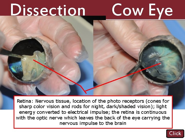 Dissection 101: Cow Eye Retina: Nervous tissue, location of the photo receptors (cones for
