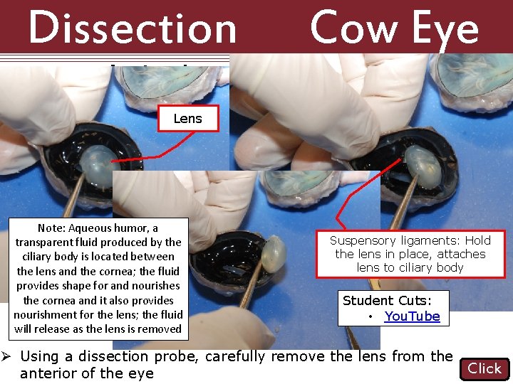 Dissection Cow Eye Anterior Identification 101: Lens Note: Aqueous humor, a transparent fluid produced