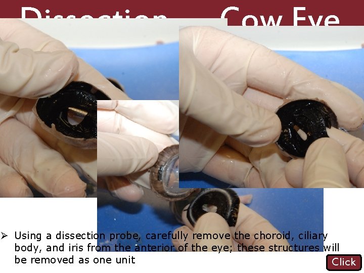 Dissection 101: Cow Eye Ø Using a dissection probe, carefully remove the choroid, ciliary