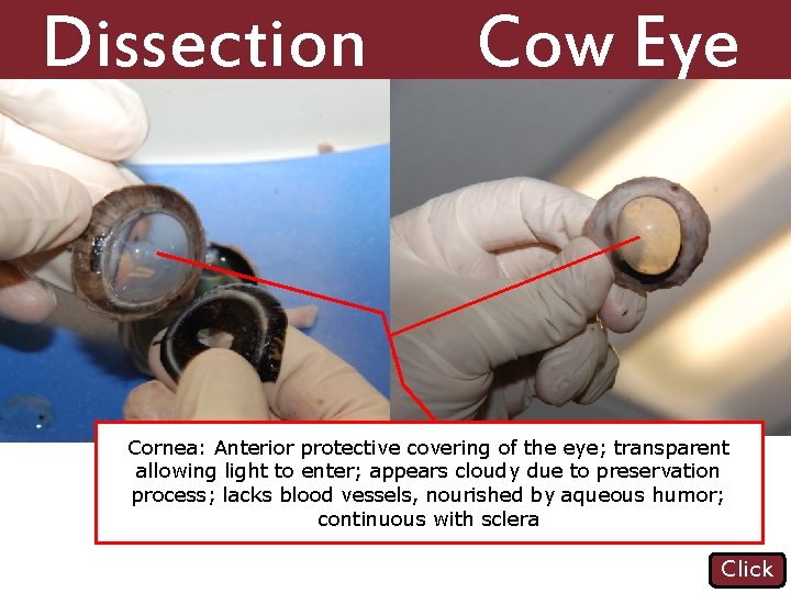 Dissection 101: Cow Eye Cornea: Anterior protective covering of the eye; transparent allowing light
