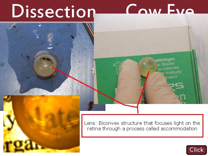 Dissection 101: Cow Eye Lens: Biconvex structure that focuses light on the retina through