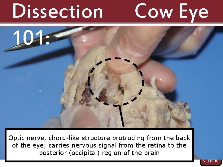 Dissection 101: Cow Eye Optic nerve, chord-like structure protruding from the back of the