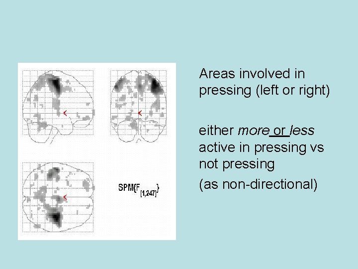 Areas involved in pressing (left or right) either more or less active in pressing