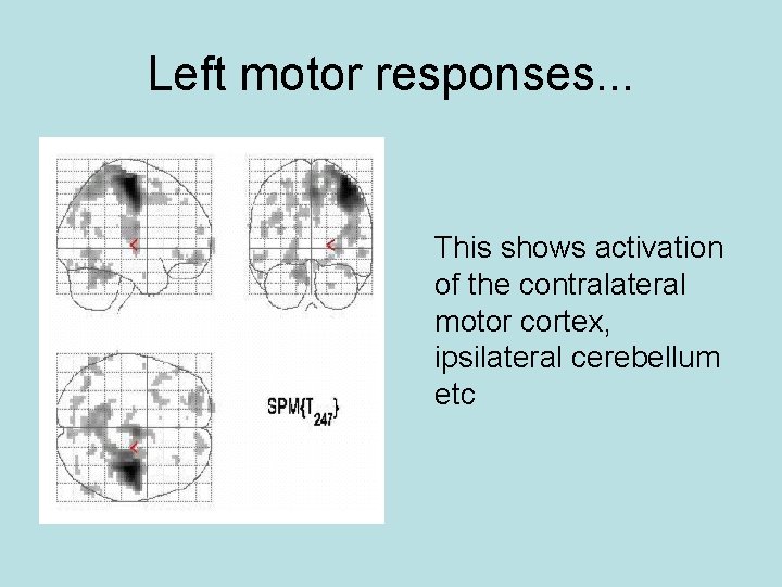 Left motor responses. . . This shows activation of the contralateral motor cortex, ipsilateral