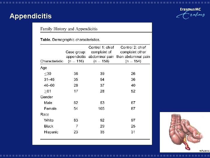 Appendicitis 