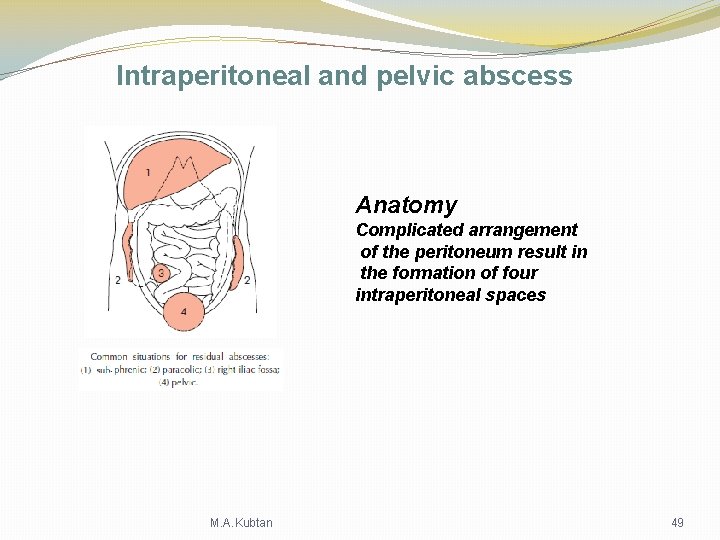 Intraperitoneal and pelvic abscess Anatomy Complicated arrangement of the peritoneum result in the formation Intraperitoneal and pelvic abscess Anatomy Complicated arrangement of the peritoneum result in the formation