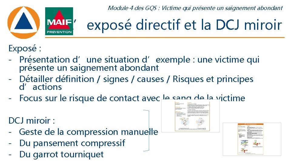 Module 4 des GQS : Victime qui présente un saignement abondant L’exposé directif et