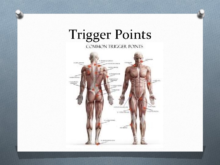 Trigger Points 