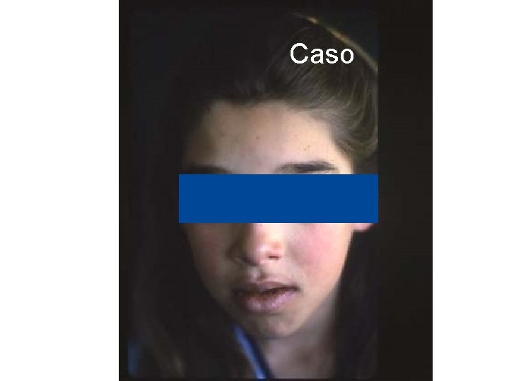 Caso Caso