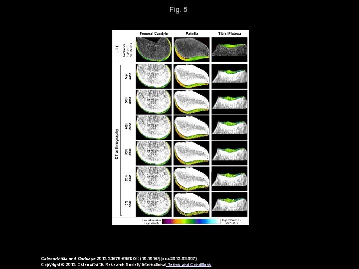 Fig. 5 Osteoarthritis and Cartilage 2012 20678 -685 DOI: (10. 1016/j. joca. 2012. 03.