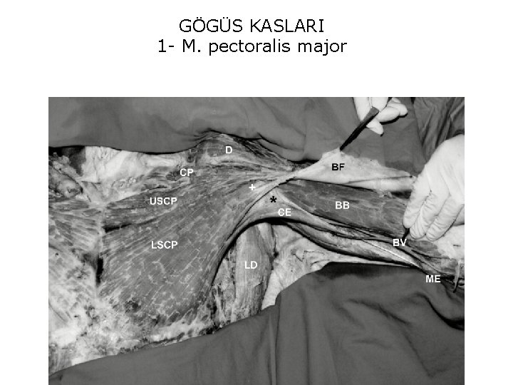 GÖGÜS KASLARI 1 - M. pectoralis major 