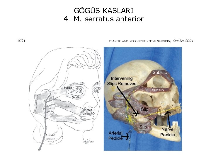 GÖGÜS KASLARI 4 - M. serratus anterior 
