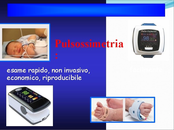 Pulsossimetria : esame rapido, non invasivo, economico, riproducibile facilmente 