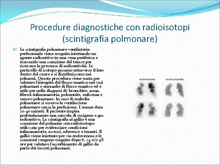 Procedure diagnostiche con radioisotopi (scintigrafia polmonare) La scintigrafia polmonare ventilatoriaperfusionale viene eseguita iniettando un