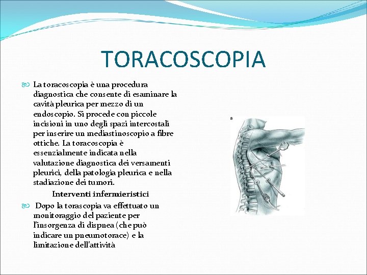 TORACOSCOPIA La toracoscopia è una procedura diagnostica che consente di esaminare la cavità pleurica