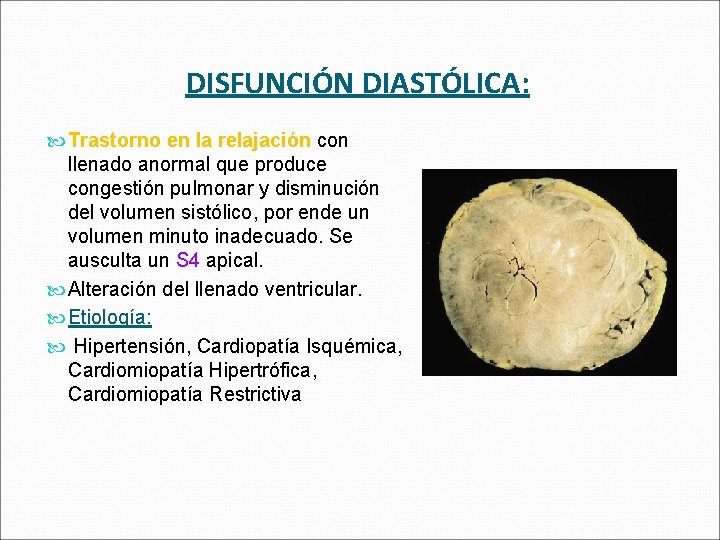 DISFUNCIÓN DIASTÓLICA: Trastorno en la relajación con llenado anormal que produce congestión pulmonar y