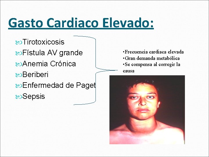 Gasto Cardiaco Elevado: Tirotoxicosis Fístula AV grande Anemia Crónica Beriberi Enfermedad de Paget Sepsis