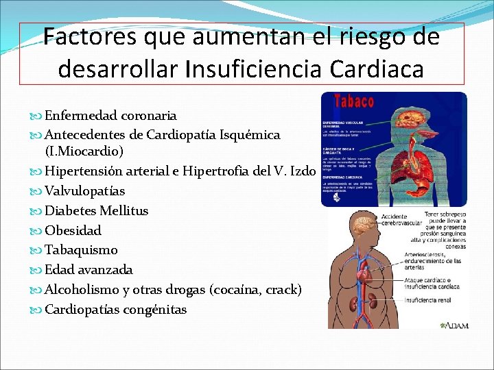 Factores que aumentan el riesgo de desarrollar Insuficiencia Cardiaca Enfermedad coronaria Antecedentes de Cardiopatía