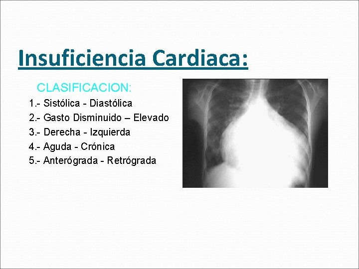 Insuficiencia Cardiaca: CLASIFICACION: 1. - Sistólica - Diastólica 2. - Gasto Disminuido – Elevado