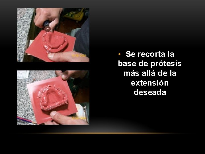 • Se recorta la base de prótesis más allá de la extensión deseada • Se recorta la base de prótesis más allá de la extensión deseada
