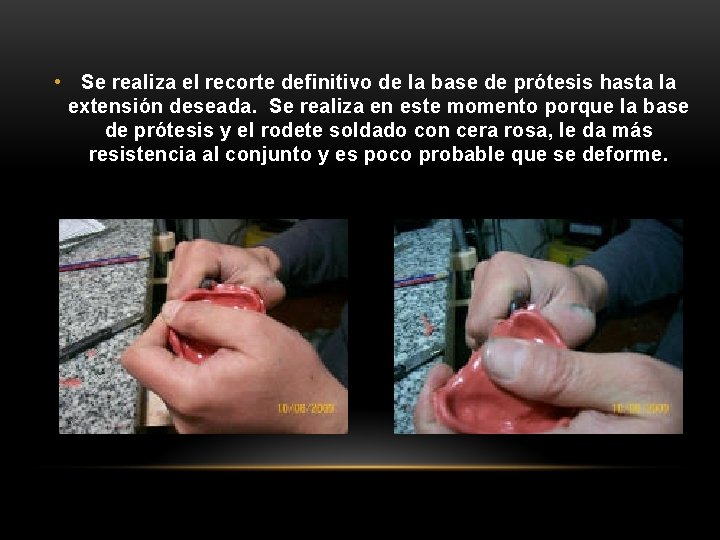 • Se realiza el recorte definitivo de la base de prótesis hasta la • Se realiza el recorte definitivo de la base de prótesis hasta la