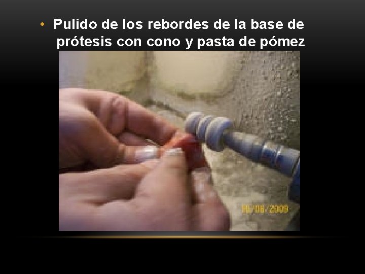 • Pulido de los rebordes de la base de prótesis cono y pasta • Pulido de los rebordes de la base de prótesis cono y pasta