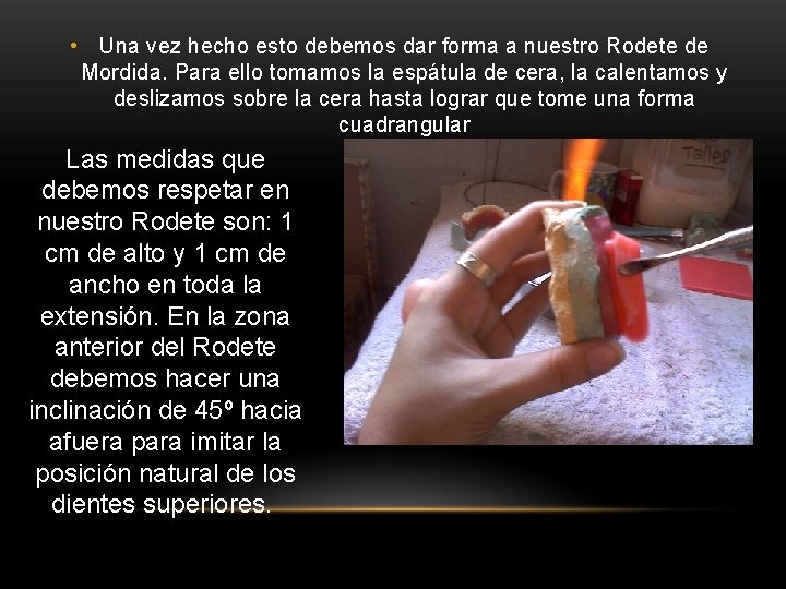 • Una vez hecho esto debemos dar forma a nuestro Rodete de Mordida. • Una vez hecho esto debemos dar forma a nuestro Rodete de Mordida.