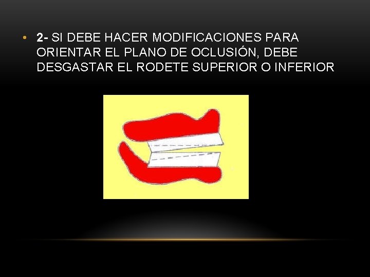 • 2 - SI DEBE HACER MODIFICACIONES PARA ORIENTAR EL PLANO DE OCLUSIÓN, • 2 - SI DEBE HACER MODIFICACIONES PARA ORIENTAR EL PLANO DE OCLUSIÓN,