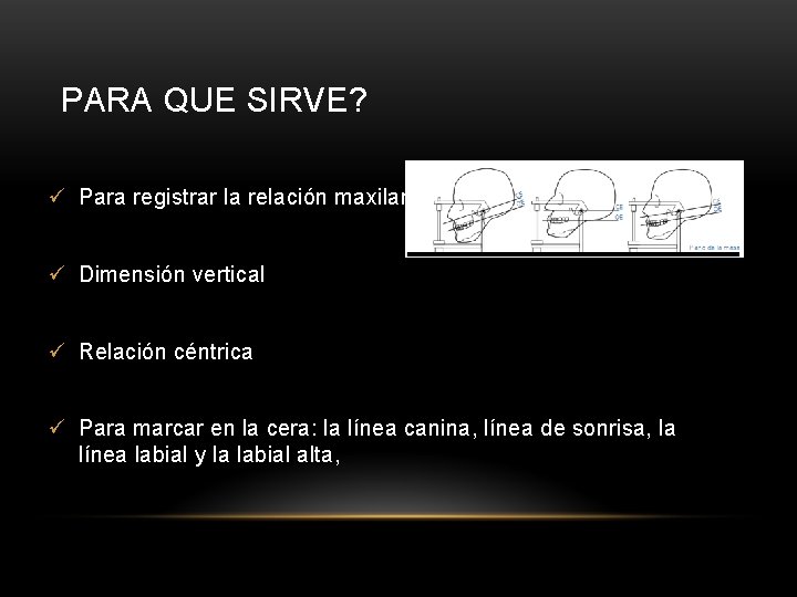 PARA QUE SIRVE? ü Para registrar la relación maxilar ü Dimensión vertical ü Relación PARA QUE SIRVE? ü Para registrar la relación maxilar ü Dimensión vertical ü Relación
