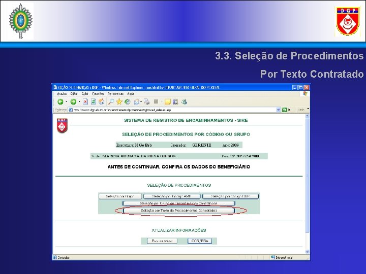 3. 3. Seleção de Procedimentos Por Texto Contratado 