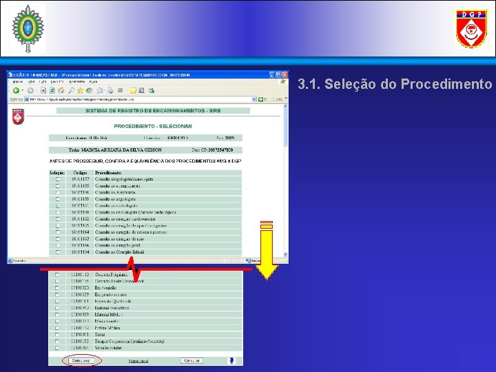 3. 1. Seleção do Procedimento 