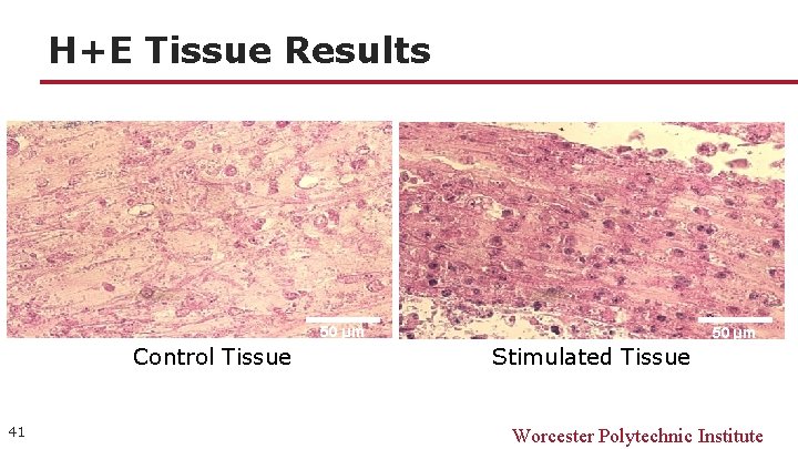 H+E Tissue Results 50 µm Control Tissue 41 50 µm Stimulated Tissue Worcester Polytechnic